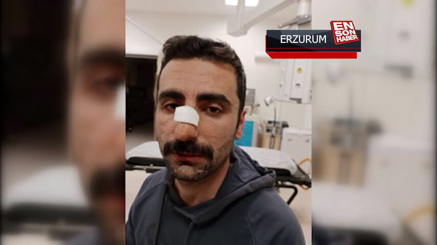 Müdür yardımcısı nöbetçi öğretmenin eşi tarafından darbedildi